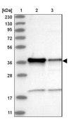Anti-ZC3H8 antibody produced in rabbit Prestige Antibodies® Powered by Atlas Antibodies, affinity isolated antibody, buffered aqueous glycerol solution