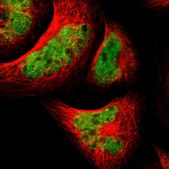 Anti-TAF5 antibody produced in rabbit Ab2, Prestige Antibodies® Powered by Atlas Antibodies, affinity isolated antibody, buffered aqueous glycerol solution