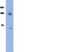Anti-HDAC7 Antibody from rabbit, purified by affinity chromatography