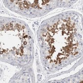 Anti-ADAM2 antibody produced in rabbit Prestige Antibodies® Powered by Atlas Antibodies, affinity isolated antibody, buffered aqueous glycerol solution, Ab1