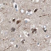 Anti-ZHX2 antibody produced in rabbit Prestige Antibodies® Powered by Atlas Antibodies, affinity isolated antibody, buffered aqueous glycerol solution