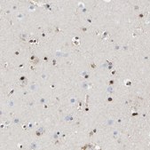 Anti-QKI antibody produced in rabbit Prestige Antibodies® Powered by Atlas Antibodies, affinity isolated antibody, buffered aqueous glycerol solution