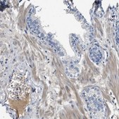 Anti-C1S antibody produced in rabbit Prestige Antibodies® Powered by Atlas Antibodies, affinity isolated antibody, buffered aqueous glycerol solution