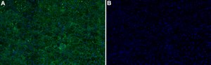 Anti-CYP11B1 Antibody, clone 1J14 ZooMAb® Rabbit Monoclonal recombinant, expressed in HEK 293 cells
