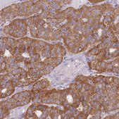 Anti-MRPS9 antibody produced in rabbit Prestige Antibodies® Powered by Atlas Antibodies, affinity isolated antibody, buffered aqueous glycerol solution