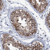 Anti-NECTIN2 antibody produced in rabbit Prestige Antibodies® Powered by Atlas Antibodies, affinity isolated antibody, buffered aqueous glycerol solution