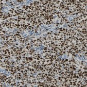 Anti-BCL6 antibody produced in rabbit Prestige Antibodies® Powered by Atlas Antibodies, affinity isolated antibody, buffered aqueous glycerol solution