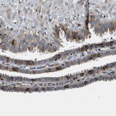 Anti-ESYT1 antibody produced in rabbit Prestige Antibodies® Powered by Atlas Antibodies, affinity isolated antibody, buffered aqueous glycerol solution