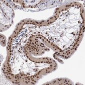 Anti-ARNT antibody produced in rabbit Prestige Antibodies® Powered by Atlas Antibodies, affinity isolated antibody, buffered aqueous glycerol solution