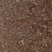 Anti-FBP1 antibody produced in rabbit Prestige Antibodies® Powered by Atlas Antibodies, affinity isolated antibody, buffered aqueous glycerol solution