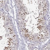 Anti-C16orf86 antibody produced in rabbit Prestige Antibodies® Powered by Atlas Antibodies, affinity isolated antibody