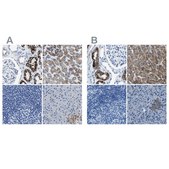 Anti-AMACR antibody produced in rabbit affinity isolated antibody, buffered aqueous glycerol solution