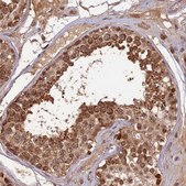 Anti-RGL3 antibody produced in rabbit Prestige Antibodies® Powered by Atlas Antibodies, affinity isolated antibody, buffered aqueous glycerol solution