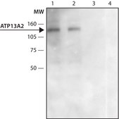 Anti-ATP13A2 (C-terminal region) antibody produced in rabbit ~1.5 mg/mL, affinity isolated antibody, buffered aqueous solution