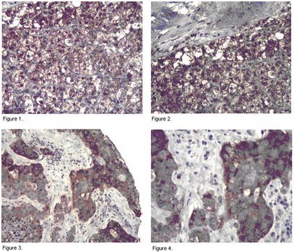 Anti-PP6R3 Antibody from rabbit, purified by affinity chromatography