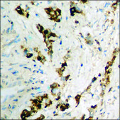 Anti-phospho-ICK (pTyr159) antibody produced in rabbit affinity isolated antibody