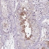 Anti-SLC30A3 antibody produced in rabbit Prestige Antibodies® Powered by Atlas Antibodies, affinity isolated antibody, buffered aqueous glycerol solution