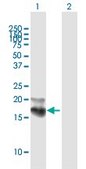 Anti-NPC2 antibody produced in mouse purified immunoglobulin, buffered aqueous solution
