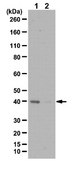 Anti-phospho PDHE1-A type I (Ser300) Antibody from rabbit, purified by affinity chromatography