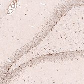 Monoclonal Anti-SOX4 antibody produced in mouse Prestige Antibodies® Powered by Atlas Antibodies, clone CL5665, purified immunoglobulin, buffered aqueous glycerol solution