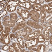 Anti-TRIM5 antibody produced in rabbit Prestige Antibodies® Powered by Atlas Antibodies, affinity isolated antibody, buffered aqueous glycerol solution, Ab1