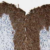 Anti-STK40 antibody produced in rabbit Prestige Antibodies® Powered by Atlas Antibodies, affinity isolated antibody, buffered aqueous glycerol solution
