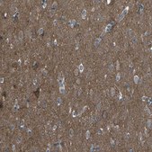 Anti-CMTM4 antibody produced in rabbit Prestige Antibodies® Powered by Atlas Antibodies, affinity isolated antibody, buffered aqueous glycerol solution