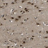 Anti-FAM172A antibody produced in rabbit Prestige Antibodies® Powered by Atlas Antibodies, affinity isolated antibody, buffered aqueous glycerol solution