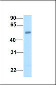 Anti-PLXDC1 antibody produced in rabbit affinity isolated antibody