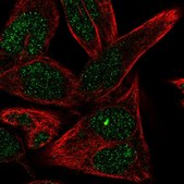 Anti-ST6GALNAC6 antibody produced in rabbit Prestige Antibodies® Powered by Atlas Antibodies, affinity isolated antibody, buffered aqueous glycerol solution