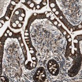 Anti-AKAP1 antibody produced in rabbit Prestige Antibodies® Powered by Atlas Antibodies, affinity isolated antibody, buffered aqueous glycerol solution