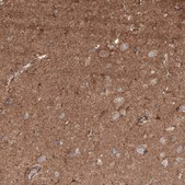 Anti-NRP2 antibody produced in rabbit Prestige Antibodies® Powered by Atlas Antibodies, affinity isolated antibody, buffered aqueous glycerol solution
