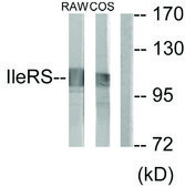 Anti-IARS2 antibody produced in rabbit affinity isolated antibody