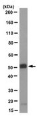 Anti-ALDH3A1, clone 10C7.1 Antibody clone 10C7.1, from mouse