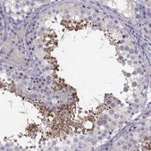 Anti-ADAM32 antibody produced in rabbit Prestige Antibodies® Powered by Atlas Antibodies, affinity isolated antibody, buffered aqueous glycerol solution