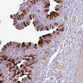 Anti-DNAJB13 antibody produced in rabbit Prestige Antibodies® Powered by Atlas Antibodies, affinity isolated antibody, buffered aqueous glycerol solution