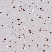 Anti-SRRM2 antibody produced in rabbit Prestige Antibodies® Powered by Atlas Antibodies, affinity isolated antibody, buffered aqueous glycerol solution
