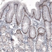 Monoclonal Anti-SOX21 antibody produced in mouse Prestige Antibodies® Powered by Atlas Antibodies, clone CL4681, purified immunoglobulin