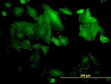 Monoclonal Anti-SDCBP antibody produced in mouse clone 2C12, purified immunoglobulin, buffered aqueous solution