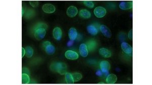 Anti-SUN1 Antibody, clone 12.10F clone 12.10F, from mouse