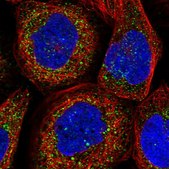 Anti-TXNDC11 antibody produced in rabbit Prestige Antibodies® Powered by Atlas Antibodies, affinity isolated antibody, buffered aqueous glycerol solution