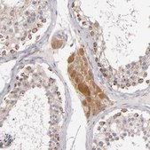 Anti-SH2D4A antibody produced in rabbit Ab1, Prestige Antibodies® Powered by Atlas Antibodies, affinity isolated antibody, buffered aqueous glycerol solution