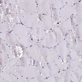 Anti-AKAP17A antibody produced in rabbit Prestige Antibodies® Powered by Atlas Antibodies, affinity isolated antibody, buffered aqueous glycerol solution