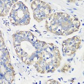 Anti-TNF-α antibody produced in rabbit