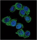 Anti-PGK1 Antibody (Center) from rabbit