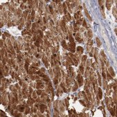 Anti-MYOM2 antibody produced in rabbit Ab1, Prestige Antibodies® Powered by Atlas Antibodies, affinity isolated antibody, buffered aqueous glycerol solution