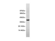 Insulin Receptor, activated, 10 µg Autoactivated on column by incubating with Mg/ATP, excess ATP &amp; MgAc removed by multiple column wash steps.