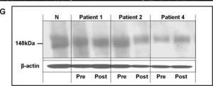 Anti-α-Dystroglycan Antibody, clone IIH6C4 ascites fluid, clone IIH6C4, Upstate®