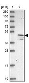 Anti-VAT1 antibody produced in rabbit Prestige Antibodies® Powered by Atlas Antibodies, affinity isolated antibody, buffered aqueous glycerol solution