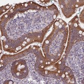 Anti-MRPS18C antibody produced in rabbit Prestige Antibodies® Powered by Atlas Antibodies, affinity isolated antibody, buffered aqueous glycerol solution